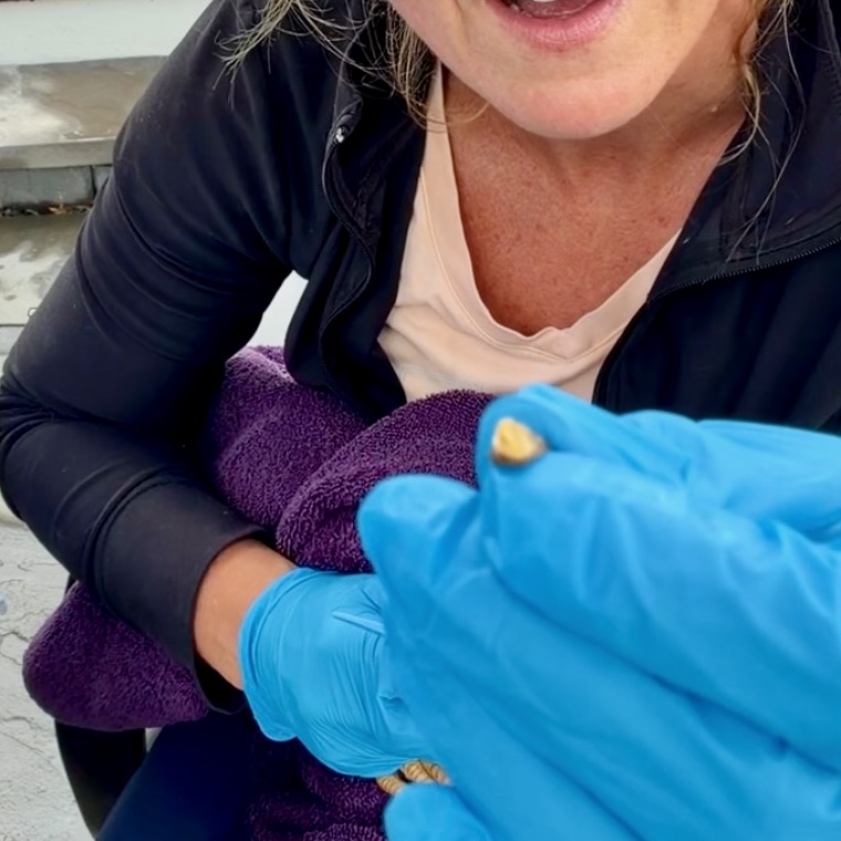 a person holding a kernel from bumblefoot
