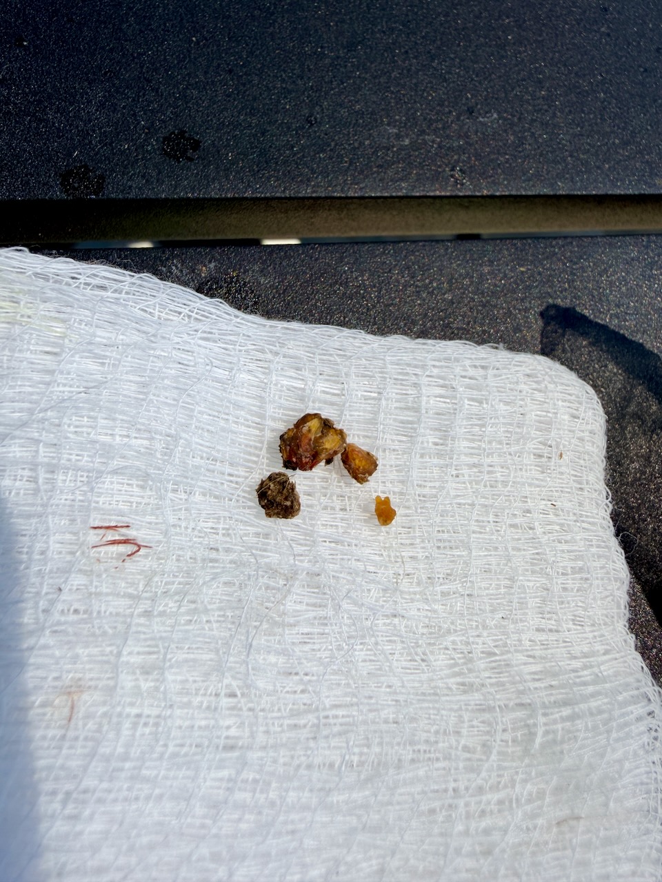 kernels and scabs from bumblefoot on a gauze
